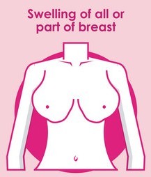 breast-swelling